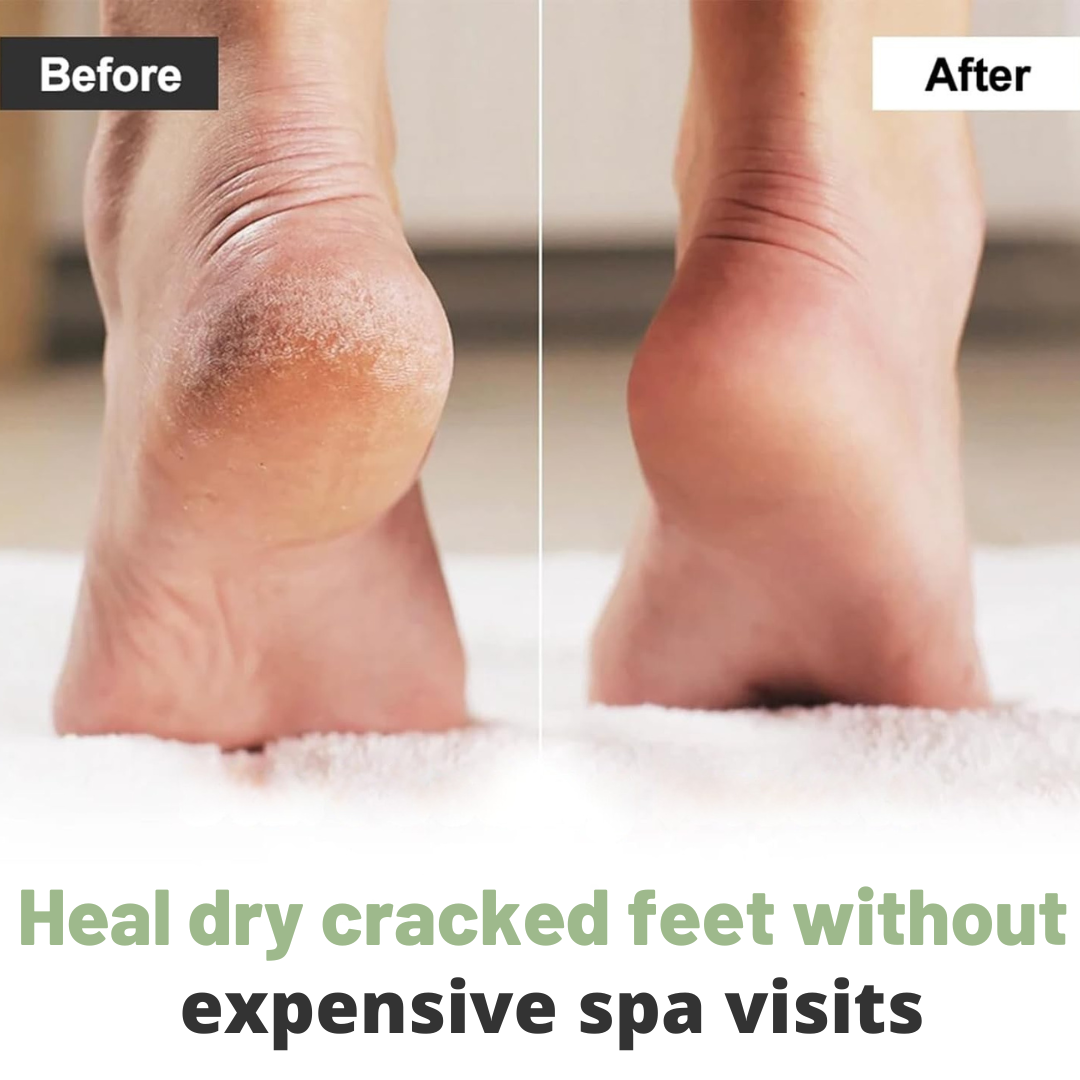 Solevera™ Foot Moisture Masks